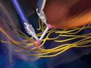 Prostate Cancer daVinci Robotic Prostat