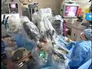 View of Robotic Surgery for Prostate C.