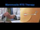 MammoSite Radiation Therapy for Breast C