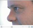 Drug for Kidney Metastatic Kidney Cancer